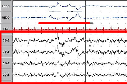 Datei:Sleep EEG REM crop.png