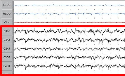 Datei:Sleep EEG Stage 1 crop.jpg