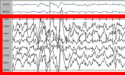 Datei:800px-Sleep EEG Stage 3 crop.jpg