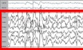 800px-Sleep EEG Stage 3 crop.jpg