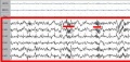 800px-Sleep EEG Stage 2 crop.jpg